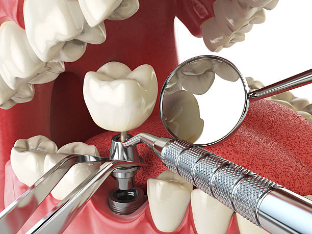 Best Emergency Treatment for Oral Infections in Bangor, WI
